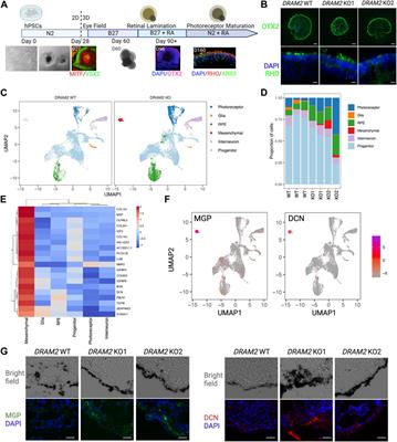 Integration of human stem cell-derived in vitro systems and mouse preclinical models identifies complex pathophysiologic mechanisms in retinal dystrophy